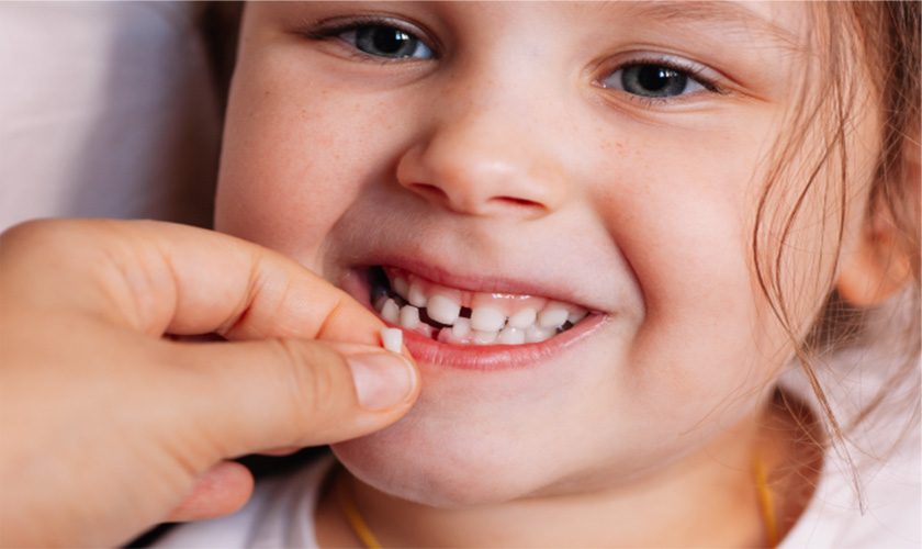 Trẻ lên mấy thì bắt đầu thay răng sữa?