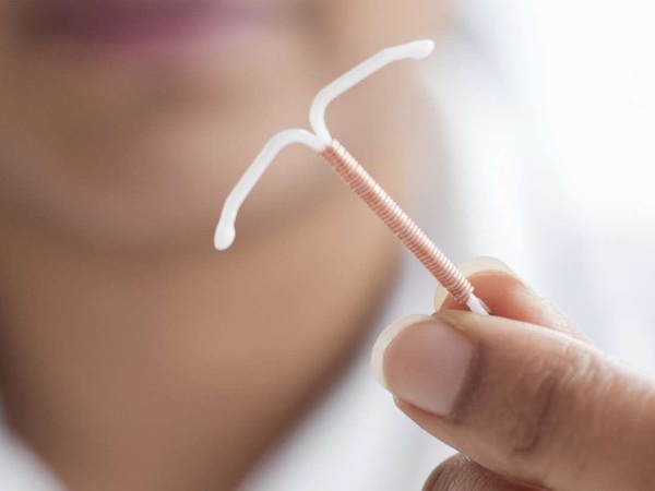 Vòng tránh thai là một dụng cụ nhỏ hình chữ T được đặt vào tử cung